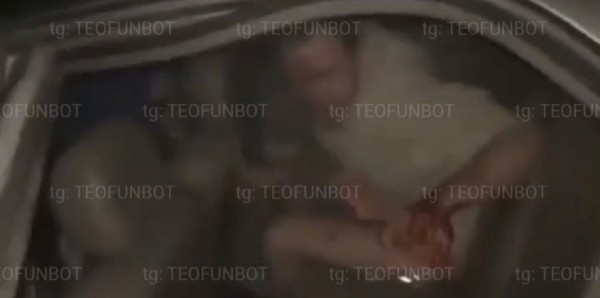 Guy lost his hand coz of a firecrack