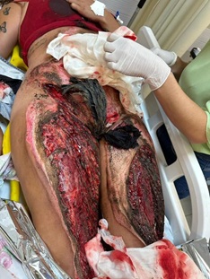 Lady Mowed Over And Dragged By Boyfriend in Brazil