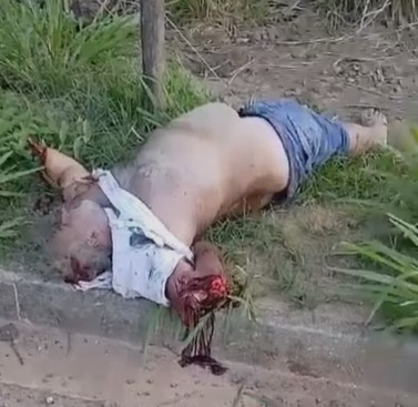 man with extreme belly victim of accident