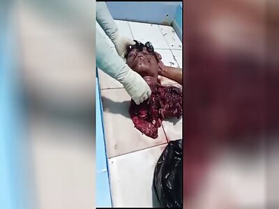 18-year-old  dragged feet first into  a wood  Chipper.