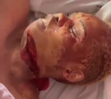 Wife Butchered by Husband with a Machete For Cheating.