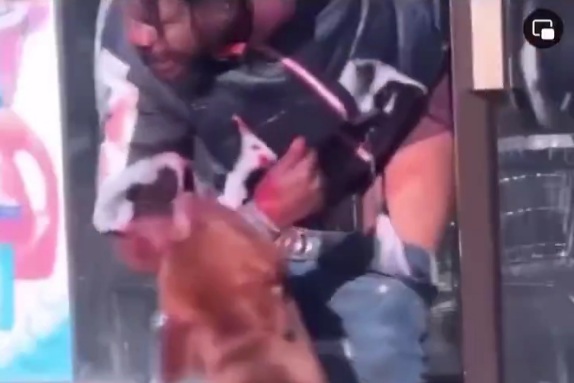 Pitbulls aren’t pets…that hand is gone 