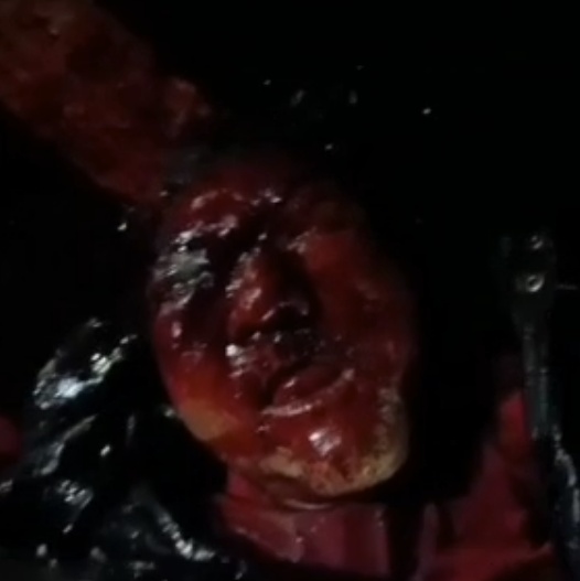 Brutal Video Shows Homeless Man Stomped To Death In Costa Rica