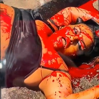 Chubby Girl Stabbed in the Neck Losing Blood Way too Fast.