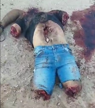 Quartered By Gang And Left In Own Hood