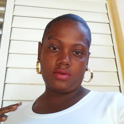 Man Throws Gasoline on Girlfriend, Sets Her On Fire In DR