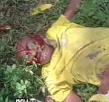 BAD DAY: Man Crushed by Falling Tree.