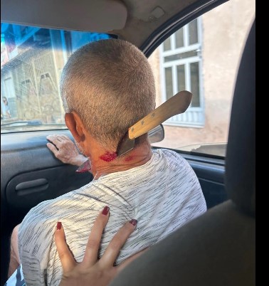 Brazilian man had knife stuck in his neck