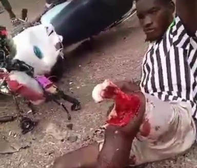 DAMN; Motorcyclist Suffers.