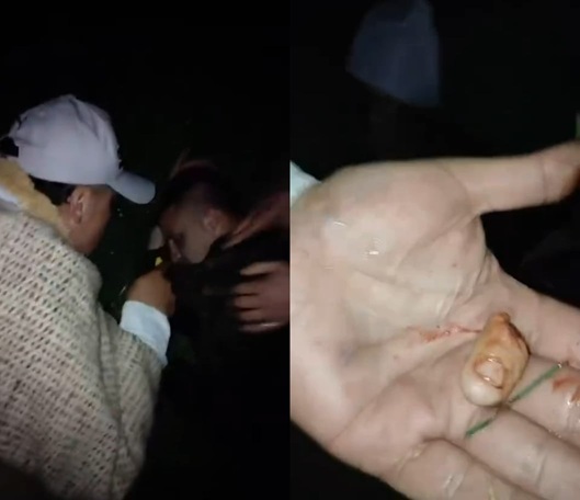 Gang Members Cut Man’s Finger Off With Box Cutter in Colombia
