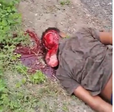 man scalped in horrific accident