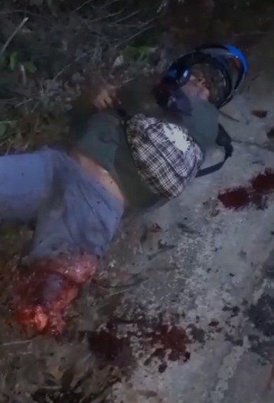 victim in agony after losing his leg