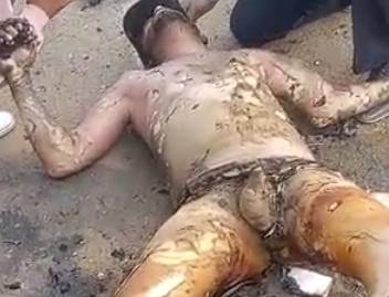  Burned Biker Takes Last Breath