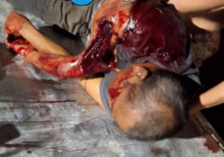 Old man killed due to fatal collision between his car and truck 