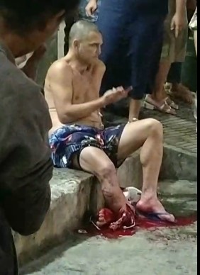 motorcyclist has leg destroyed in accident