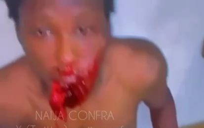 Viking member get a gunshot to the mouth 