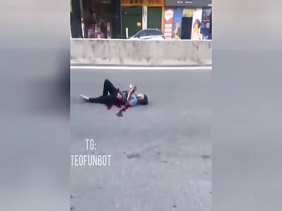 The mans guts are sticking out, but he doesnt care.