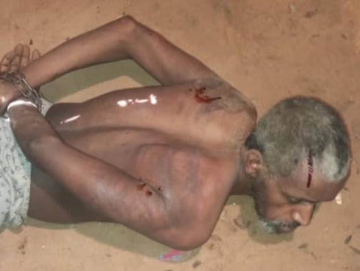 [PART1]Ethiopian old man kidnapped and tortured by Libyan militia 