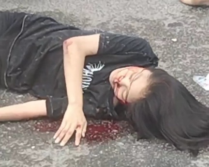 Two Girls Riding Moped Crashed Dead by Truck 