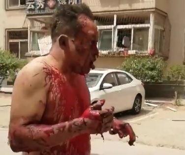 Another victim of the explosion happened today in Chinese factory 