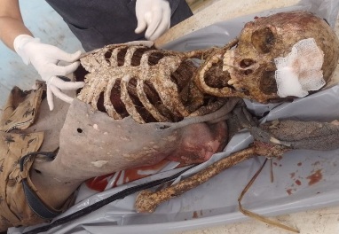 Rotten dead body with bullet wounds in morgue 