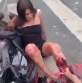 Pretty Female Bikers Broke Their Legs