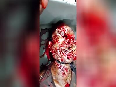 Dead body with destroyed head 