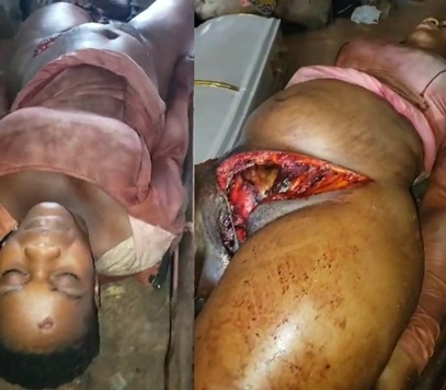 Woman's Private Part Cut Off From Her Body.