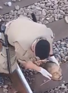 Brazilian man who lost his head