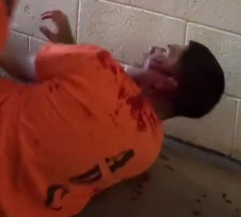 Bloody Prison Altercation (US)