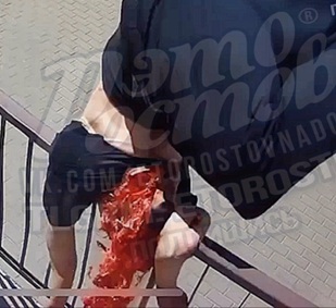 Suicidal Man Split In Half After Jumping To His Death In Russia