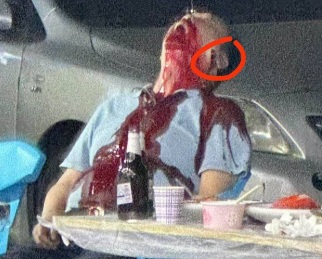 Two Chinese man victims of gang attack in Chinese restaurant 