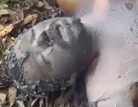 Burnt to a Crisp and Still Alive.