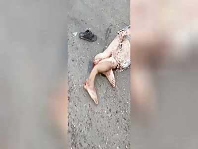 victim with legs torn apart in accident
