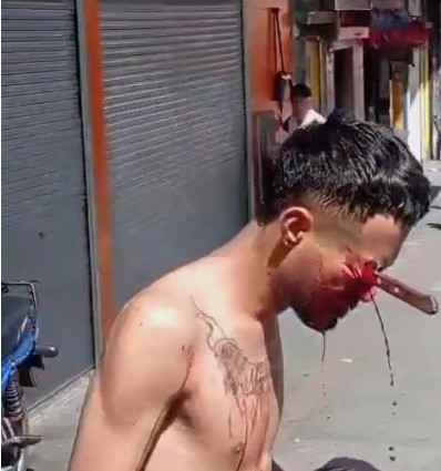 Man was stabbed in the head with a knife