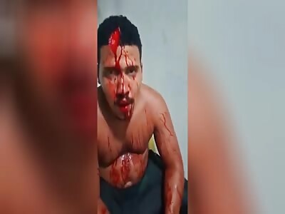 Man with serious head injury 