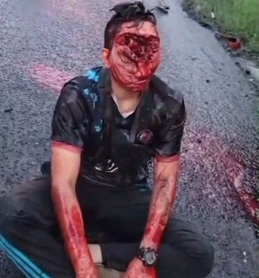 There's Always Someone Worse Off Than You