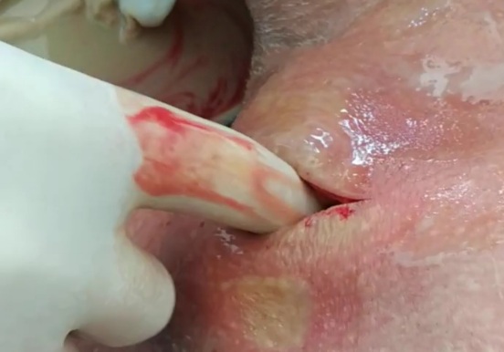 FINGERING CREAMY THROAT 