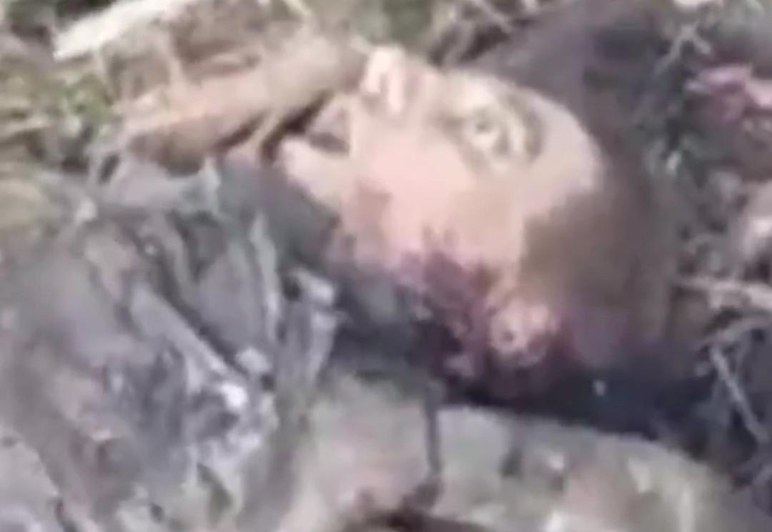 Solider with a bullet in his neck can't breathe