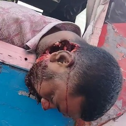 Man's Tragic Death After Sticking Head Out of Bus Window in Bangladesh