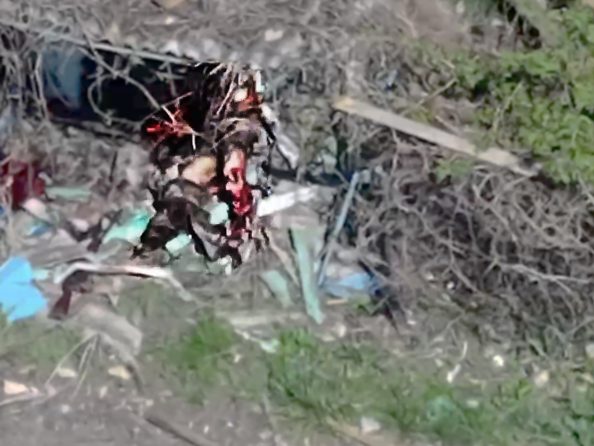 Bone Pipes as Legs Didn't Get This Russian Very Far