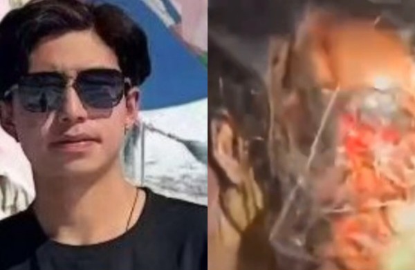 The bear tore the guy's face off