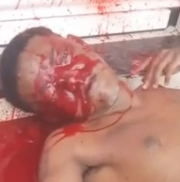 WCGW When You Sleeping Drunk On The Sidewalk In Brazil