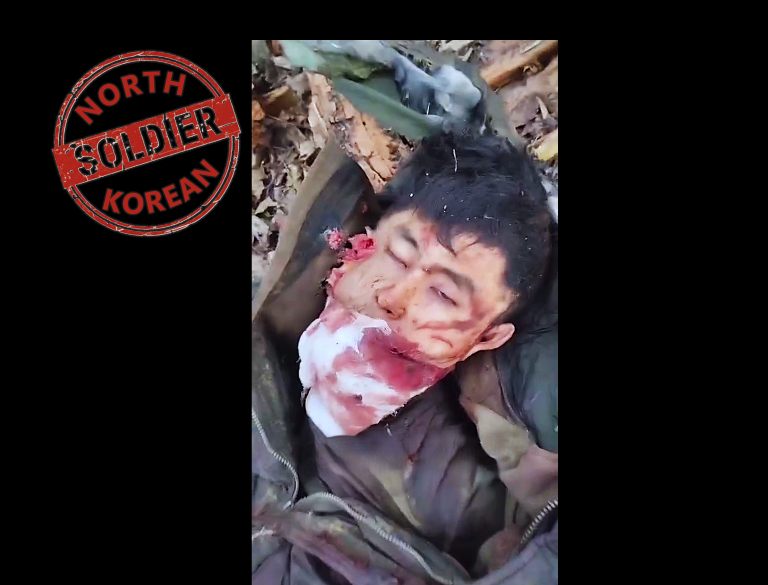 At Least N Korean Got His First Dental Job Before Dying