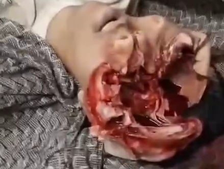 [EMPTY SKULL]Trafficker head blowing up by police 