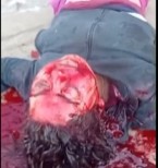 Woman has Blunt Force Trauma