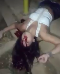 Pretty Girl Shot in the Face Still Agonizing on the Sidewalk