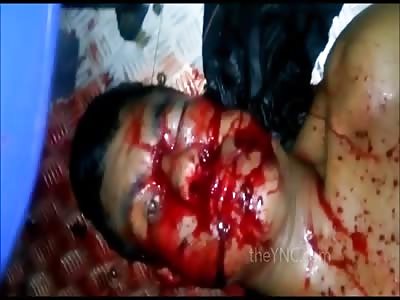 Thug Dying in Agony After Being Shot in the Face Inside Bus