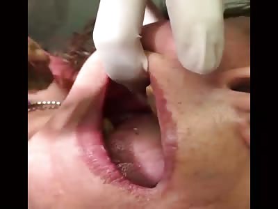 WTF is up with them chompers?