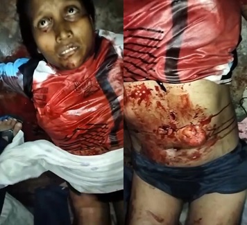 Woman Hacked Up With Machete Bleeding In Total Agony